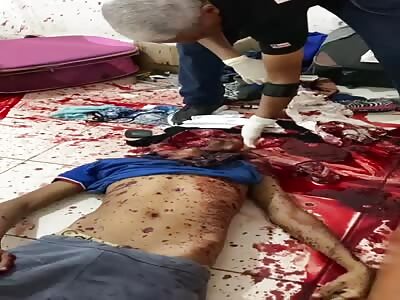 hey man did you get shot?