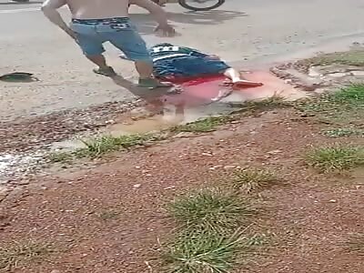 victims had leg in accident