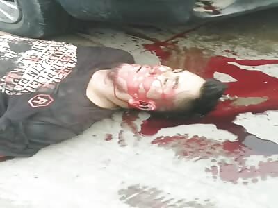 Hit by a drunk driver.