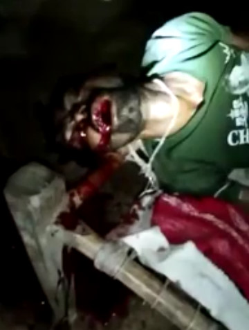 Dying on Remote Indian Island 