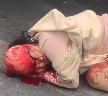 Scalped Woman in TOTAL Shock