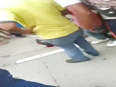 The helmet does not save his life