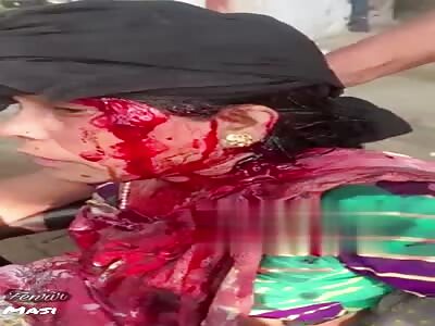 Attacked with an iron bar.