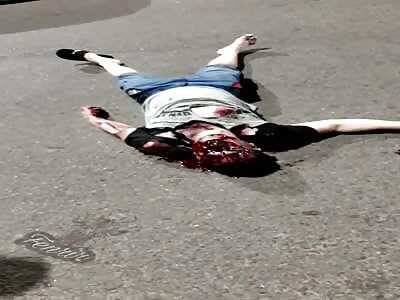 Terrible accident for a boy