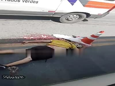 Man was crushed by a truck, brains exposed.