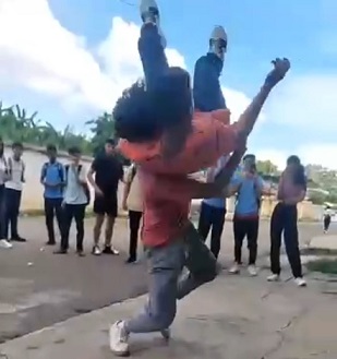 That's A Brutal Way To Get Brain Damage