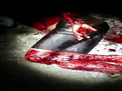 Man was attacked with edged weapons and sticks.