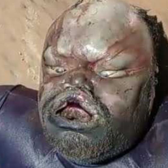 Bloated, rotting corpse on the beach.