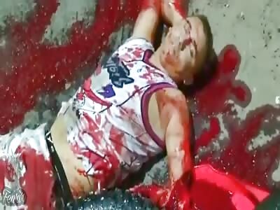 motorcyclist loses an arm in an accident 