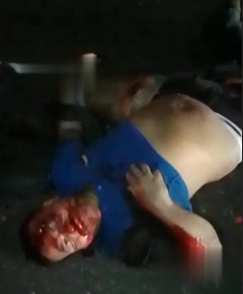 Bus collided with motorcyclist