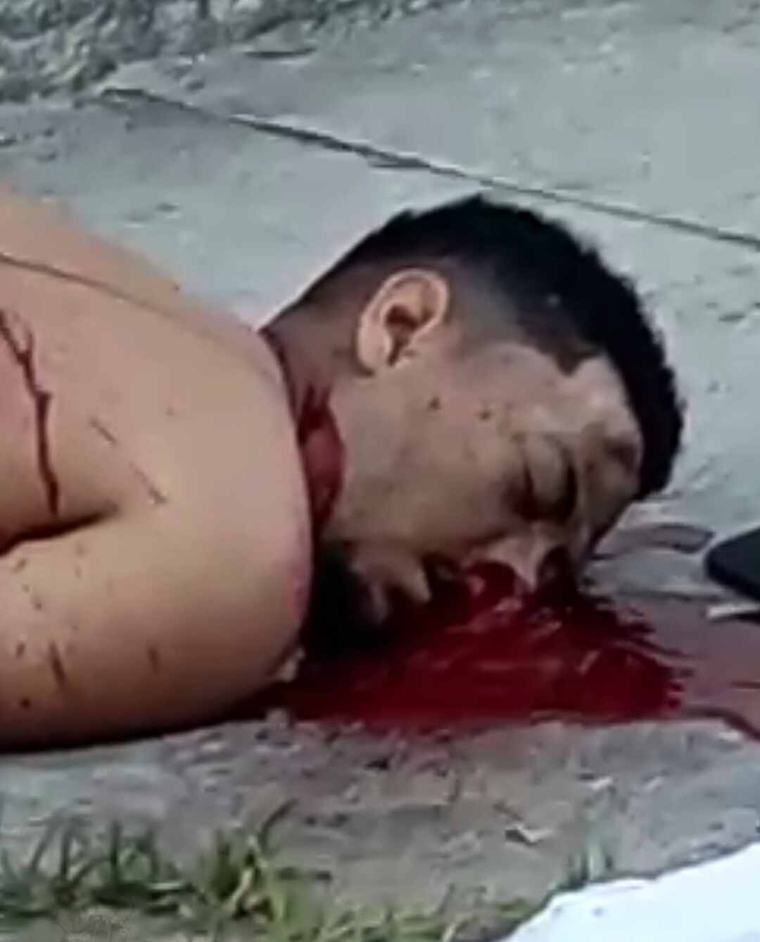 exsanguinated body on the sidewalk