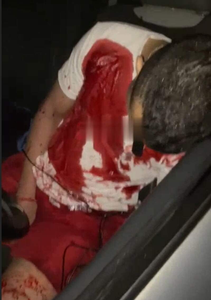 Man was killed with several shots.