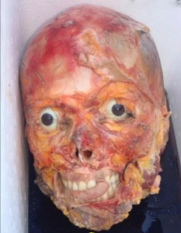 Random Death And Gore Pictures Compilation Part 2 