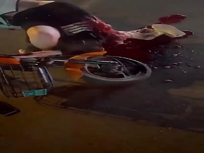 Shattered leg after accident