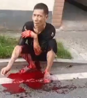 Woman wins knife fight