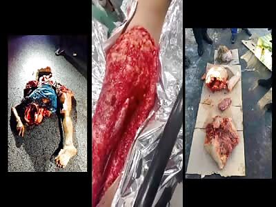 A gore overdose- Compilation 8 , vol 1