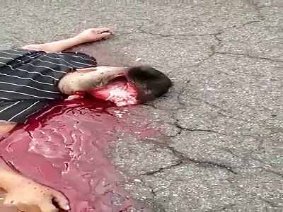 Motorcycle accident leaves man with open mind