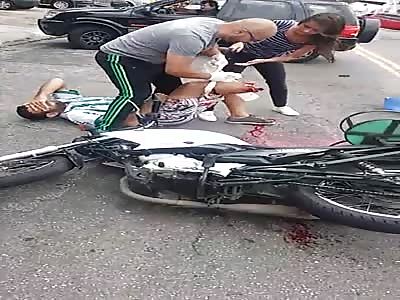 Screaming in Terror.. Young man has her Leg Ripped off on the Street  