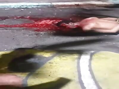 Brains Evacuated After Getting Shot More Than 50 Times