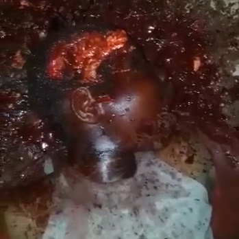 Teenager Found With Bashed-In Head, Believed Murdered by Father