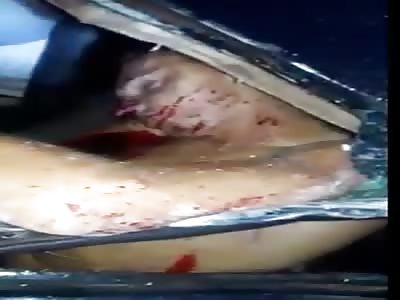 Death Waits Patiently For Victims of Accident 