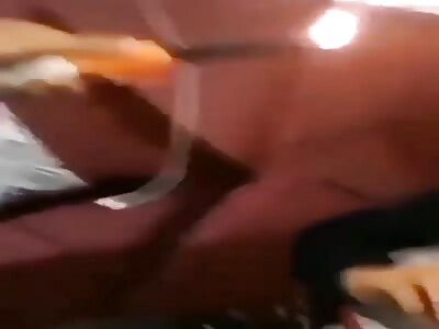 moron burns man's cheek  with cigarette lighter