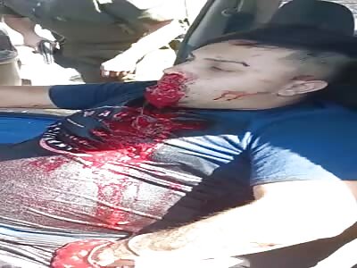 Chilean Bank Robber Vomits Blood In Horrible Agony 