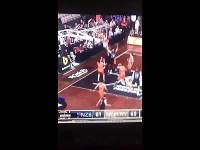 Eye Poked out of it's socket at basketball game.