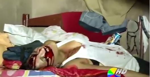 Woman Shot in the Head still holding her Beer Can in One Hand..Cigarette in the Other 