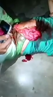 Relax..Or Try to with your Intestines Hanging out of your Stomach after Stabbing 