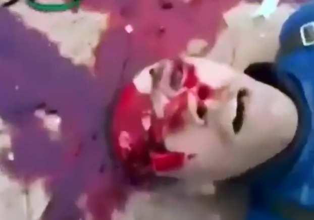 Soldier in Full Gear Took one to the Eye..Takes his Final Breaths On Camera 