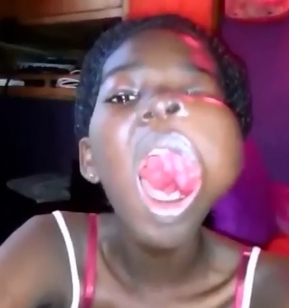 Hard to Watch Video of Girl with Terrible Tumor 