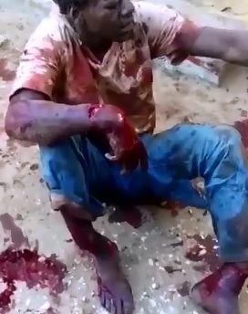 Thief Fucked Up by Machete Attack Dangling Everything 