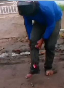 Man gets Up to Show Off his Snapped Leg to the Cameraman 