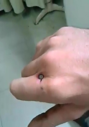 Nail right through the Hand has to Hurt