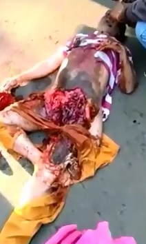 New Angle of Dude Ran over and Crushed Still Alive Talking