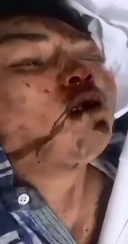 Gruesome Morgue Footage Hours after they Were Killed in Motorcycle accident 