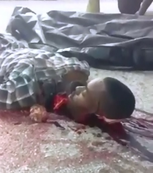 Unique Gore..Man Decapitated in Accident Looks Bizarre 