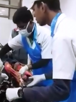 Girl Screams in Terror in the ER as Doctor moves her Destroyed Legs 