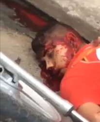 Thugs Shot Multiple Times by Police Off their Bicycles One Clinging to Life 