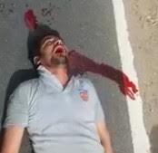 Man Dying makes the Epic Death Rattle on the Street 