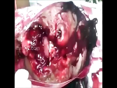 Woman's face destroyed after suicide attempt with shotgun