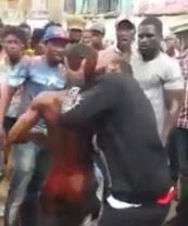 Stays Calm until He Bites the Thug's Ear Off! 