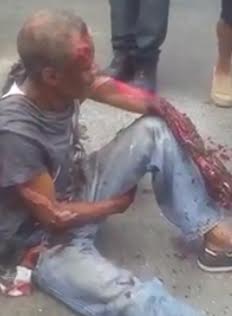 Calmly Waiting for Help as your Arm is Melting Away 