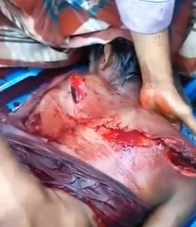 Man was hacked up by Many Many Machete Blows