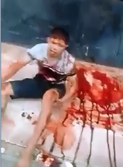 Man Begging for Help after being Shot on the Sidewalk 