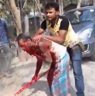 Tiger Attack: Blood Spurting from Man's Neck after Tiger Teeth Ripped into It 