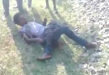 And THIS Might be the Most Fucked Up Leg I've Ever Seen 