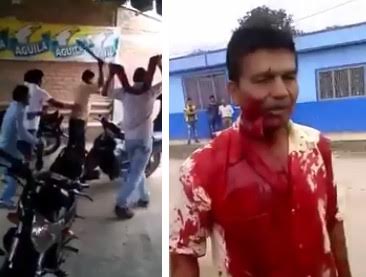 Man ends with part of his face Hanging Off after Machete fight