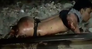 Wow Boy with Legs Ripped Off is Still Alive and asking for Help 